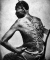 A former slave named Gordon shows his whipping scars. Baton Rouge, Louisiana, 1863.jpg